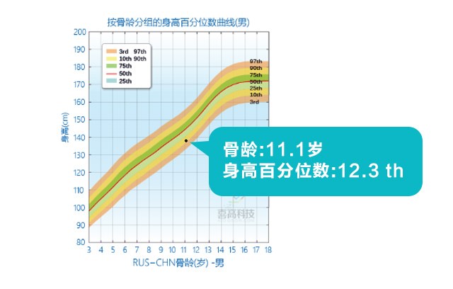 判斷孩子的高矮？這3點沒搞清楚會后悔！_05.jpg