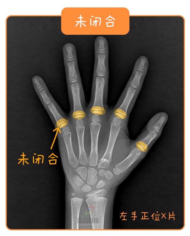 重啟骨骺線~你看起來很誘人！_12.jpg