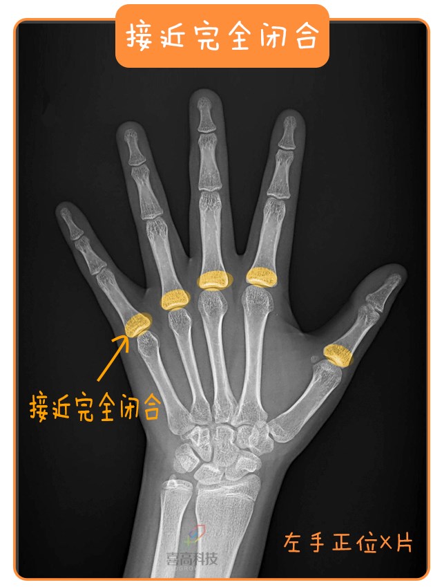 重啟骨骺線~你看起來很誘人！_13.png