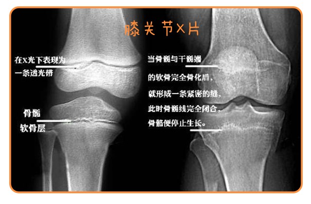 重啟骨骺線~你看起來很誘人！_14.png